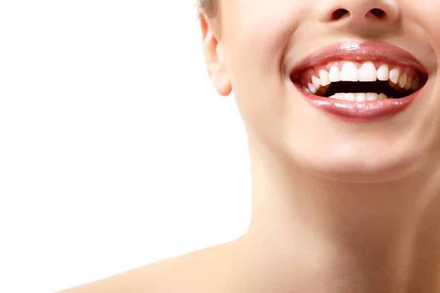teeth whitening