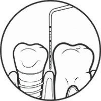 Biofilm Therapy