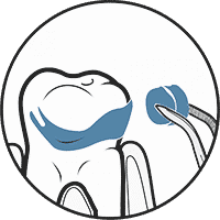 biofilm therapy