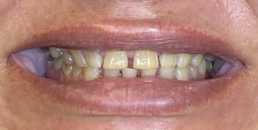 Dr Wim Before 6