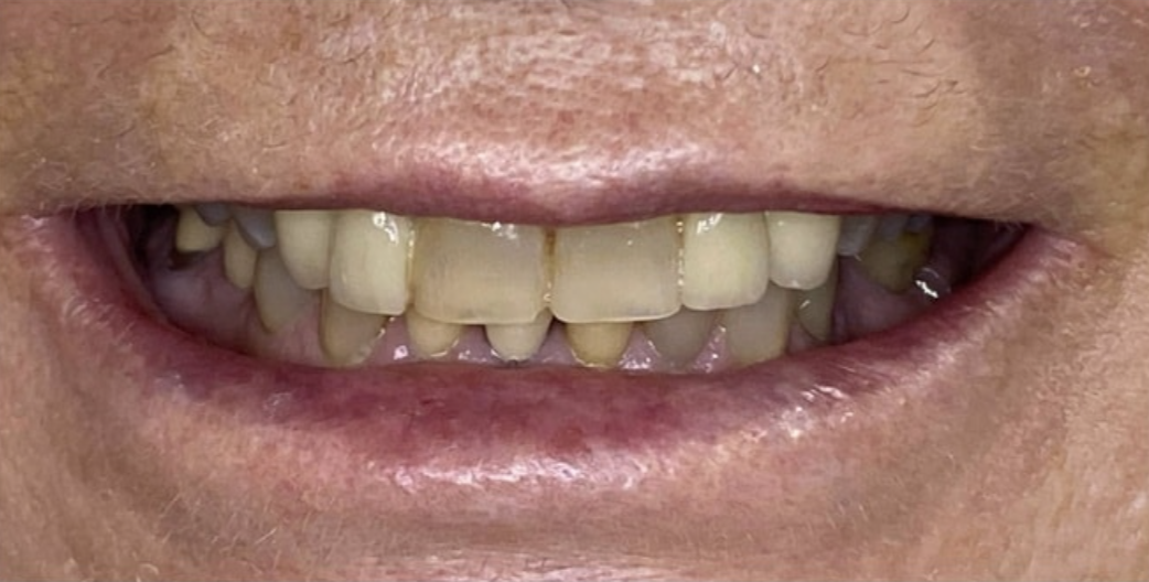 Dr Wim Before 4