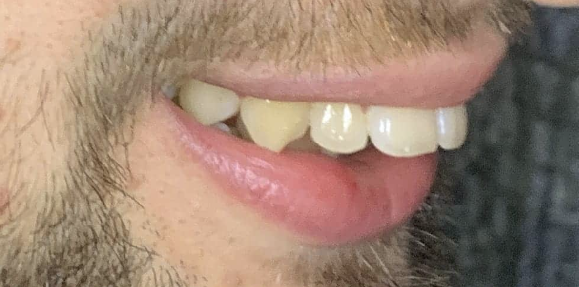 Dr Zak Before 1