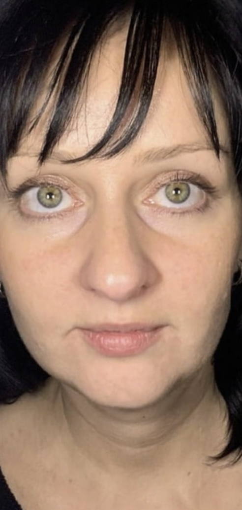 Dr Zak Aesthetics Before 5
