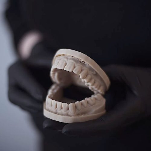 dentures2
